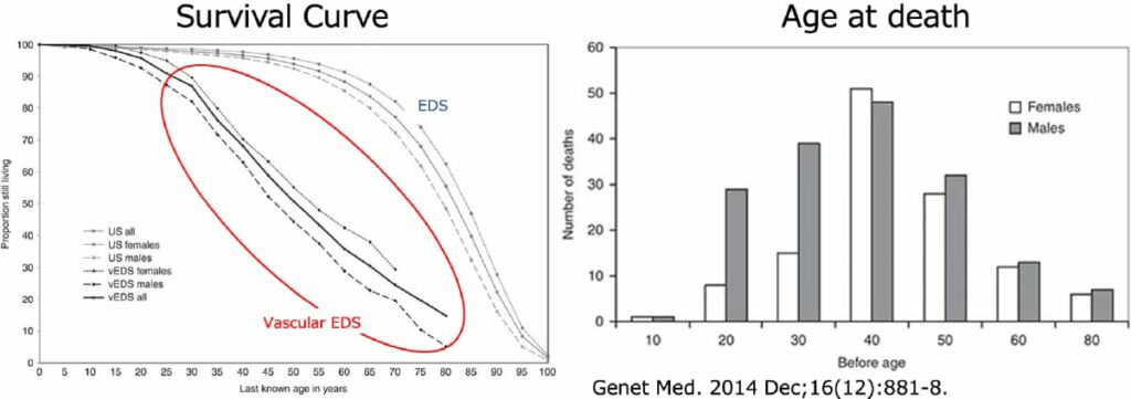 marfan syndrome life expectancy reddit